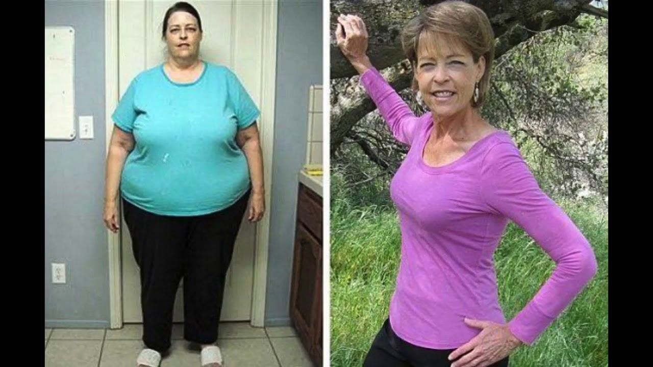 Weight Loss Transformation Before and After Compilation #2 Weight Loss Transformation Before and After Compilation #2