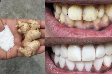 ओहियो में जस्ट 2 मिनट्स में, पास और सीन जैसे पेरिल्स, यह रेसिपी  ट्रीटमेंट सो होम