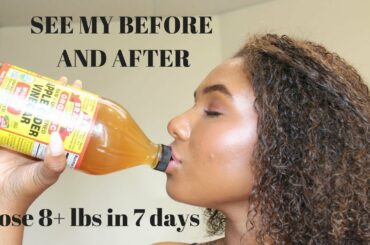 How To Lose 8 Pounds In One Week | Drinking Apple Cider Vinegar | Lose Weight Fast