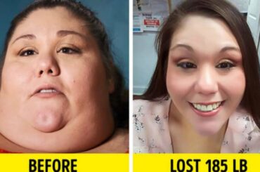 weight loss before and after pictures
