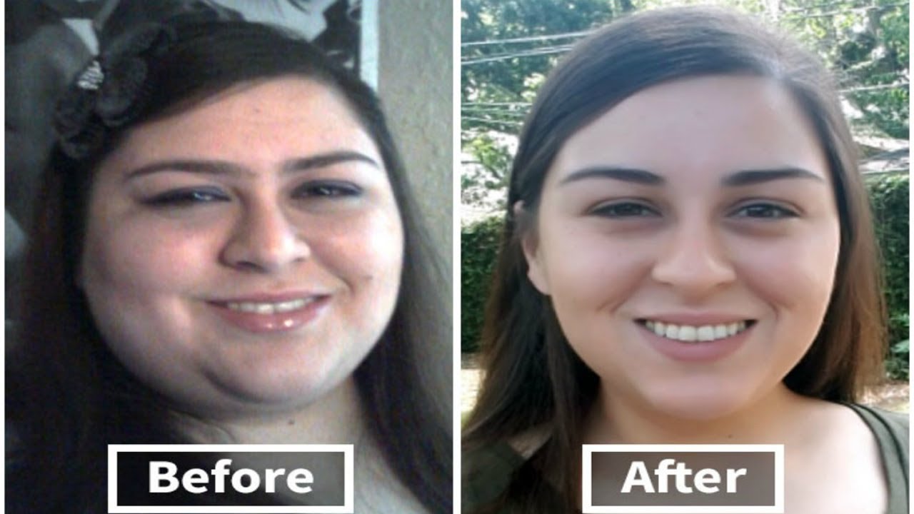 pictures of weight loss before and after pictures of weight loss before and after