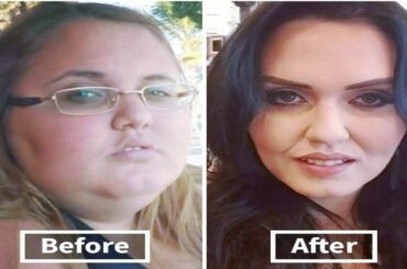before and after pictures weight loss