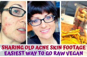 OLD ACNE SKIN FOOTAGE • EASIEST WAY TO GO RAW VEGAN • HEALTHY FOOD