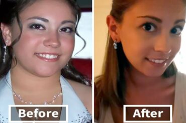 weight loss before and after pictures | weight loss before and after face