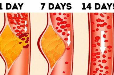 What's the DASH Diet and Why Doctors Call It the Best Diet