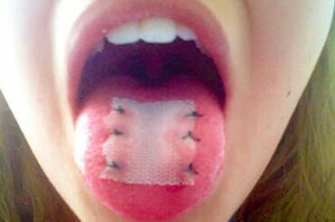 15 Craziest Methods People Use To Lose Weight!