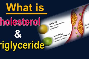 what are the symptoms of high cholesterol