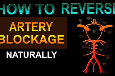 HOW TO REVERSE ARTERY BLOCKAGE NATURALLY