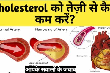 How can i lower my cholesterol naturally | Cholesterol control | Answers to your questions
