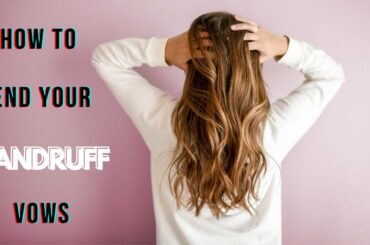 #dandruff problem solve #home remedies for Dandruff #easy tips #healthy food
