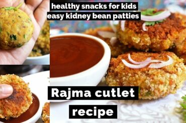 Try this Rajma Cutlet recipe, easy kidney bean patties snacks ,healthy snacks for kids DiviCookHouse