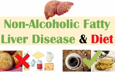Non-Alcoholic Fatty Liver Disease & Diet | Diets to Prevent and Reduce Severity of NAFLD