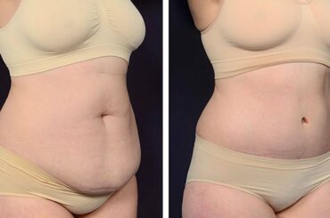 Healthy Breakfast Recipes for Weight Loss #shorts