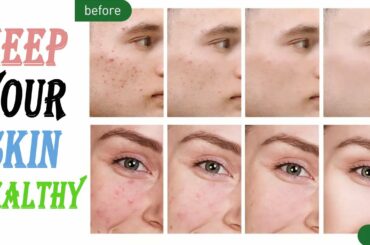 9 WAYS TO PREVENT ACNES AND KEEP YOUR SKIN HEALTHY.