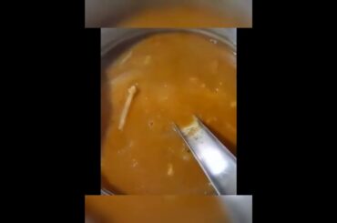 Healthy lunch recipes tamil | banana stem sambar|  #healthyfood #shorts #lunchbox #ytshorts