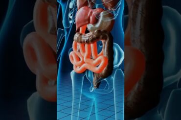 30-Day Keto Meal Plan For Healthy Weight Loss#shorts #weightloss #weightlossjourney #weightlosstips