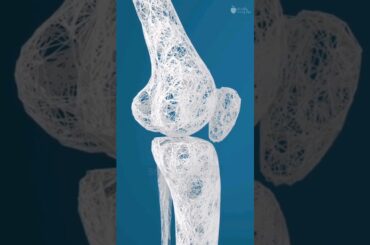 5 Surprising Benefits Of Eating Chia Seeds Everyday