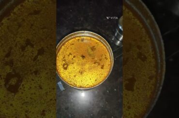 Today Lunch Box recipes/healthy lunch box ideas#lunchbox #lunchboxrecipe #healthyfood #food