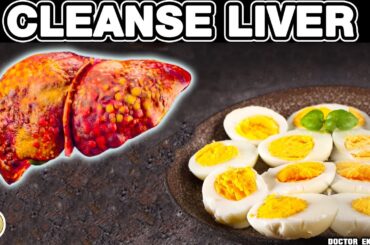 Top 10 SUPER FOODS That Can Heal A FATTY LIVER