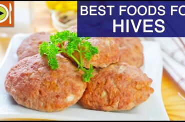 Best Foods for Hives | Healthy Recipes