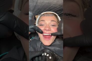 I got a smile makeover #shorts