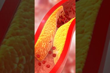 Beetroots health Benefits #healthmasteryhub