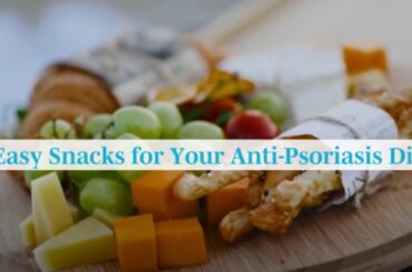 6 Easy Snacks for Your Anti-Psoriasis Diet
