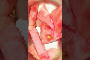 Kutties Healthy Lunch Box Recipe #shorts #kidshealthyfood