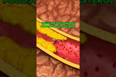 These are the 10 worst foods for cholesterol #health #healthtips #shorts #explore #healthy #body