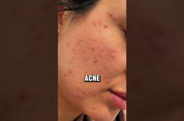 Best Anti-Aging Korean Cream Recipe | Natural Skincare for Americans | DIY Face Mask