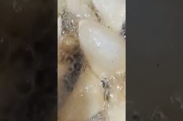 #hyderabad #easyrecipe #cooking #foodlover #food #like #taste #foodies #healthy #salt #papdi chat