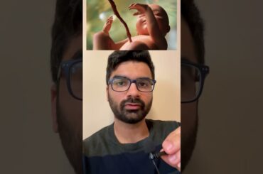 Why does the FDA recommend against eating raw sprouts during pregnancy #pregnancy #youtubeshorts