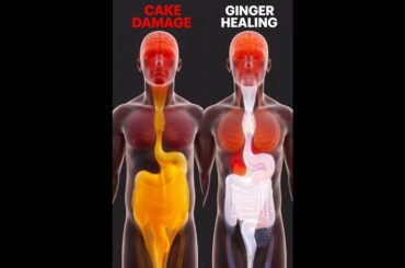 Cake Vs Ginger #cake #ginger #ytshorts #viral #health #body #shorts #facts #short #superfood #doctor