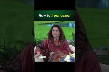 How to treat acne... #waseembadami #iqrarulhassan #shaneiftaar #shaneramazan