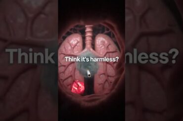 Cigarettes kill #cigarette #healthyfood #viral #healthylifestyle #viralvideo #viralshorts