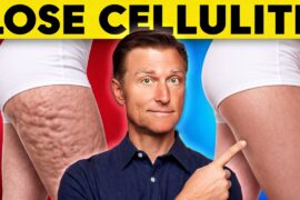 The #1 Best Way to Lose Hip & Butt Cellulite